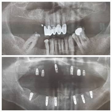 Slider image (8) Prestij Dental Clinic